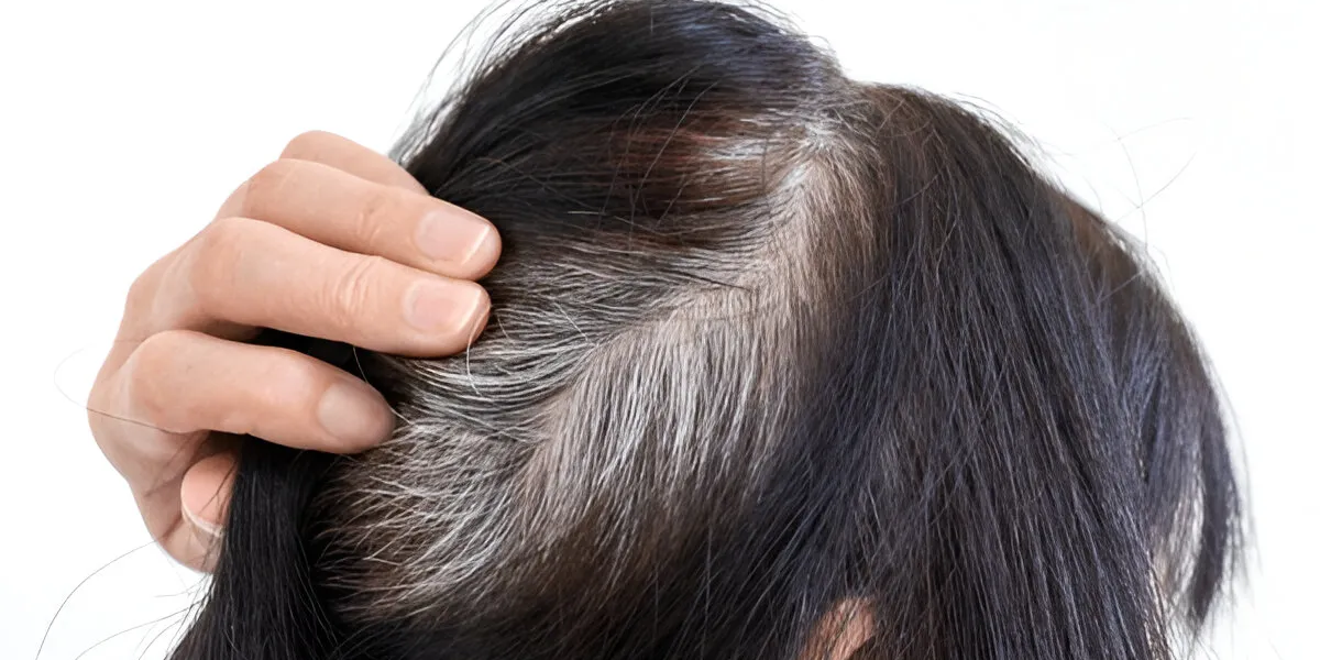 Why Grey Hair Happens and How to Manage It Naturally